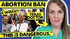 Obgyn Explique L'interdiction D'avortement Au Texas